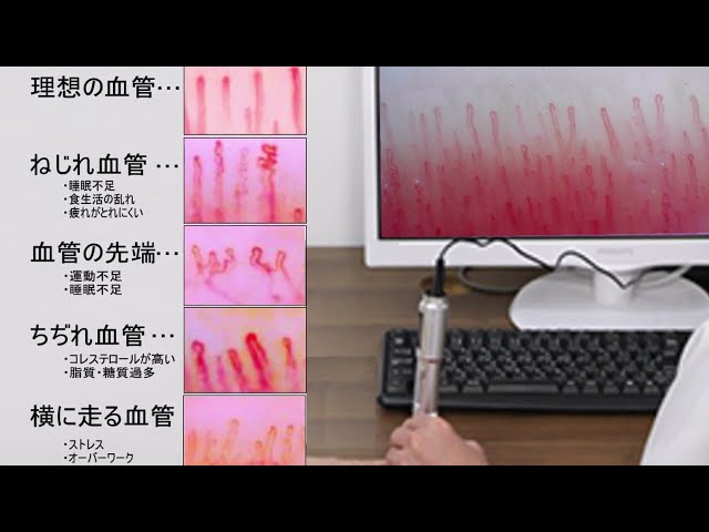 高速オートフォーカス血流スコープ HJ-G6（毛細血管スコープ）は販売