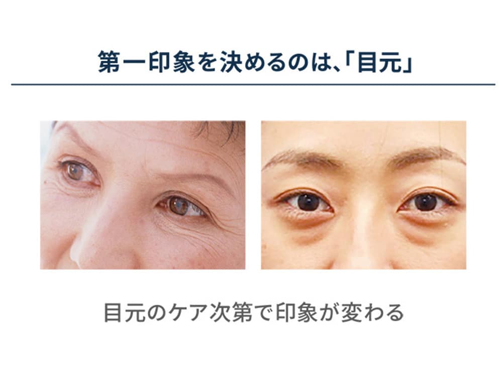 YA-MAN クリアージュ 家庭用美容機器 アイリフト CR-01P: 美容・コスメ