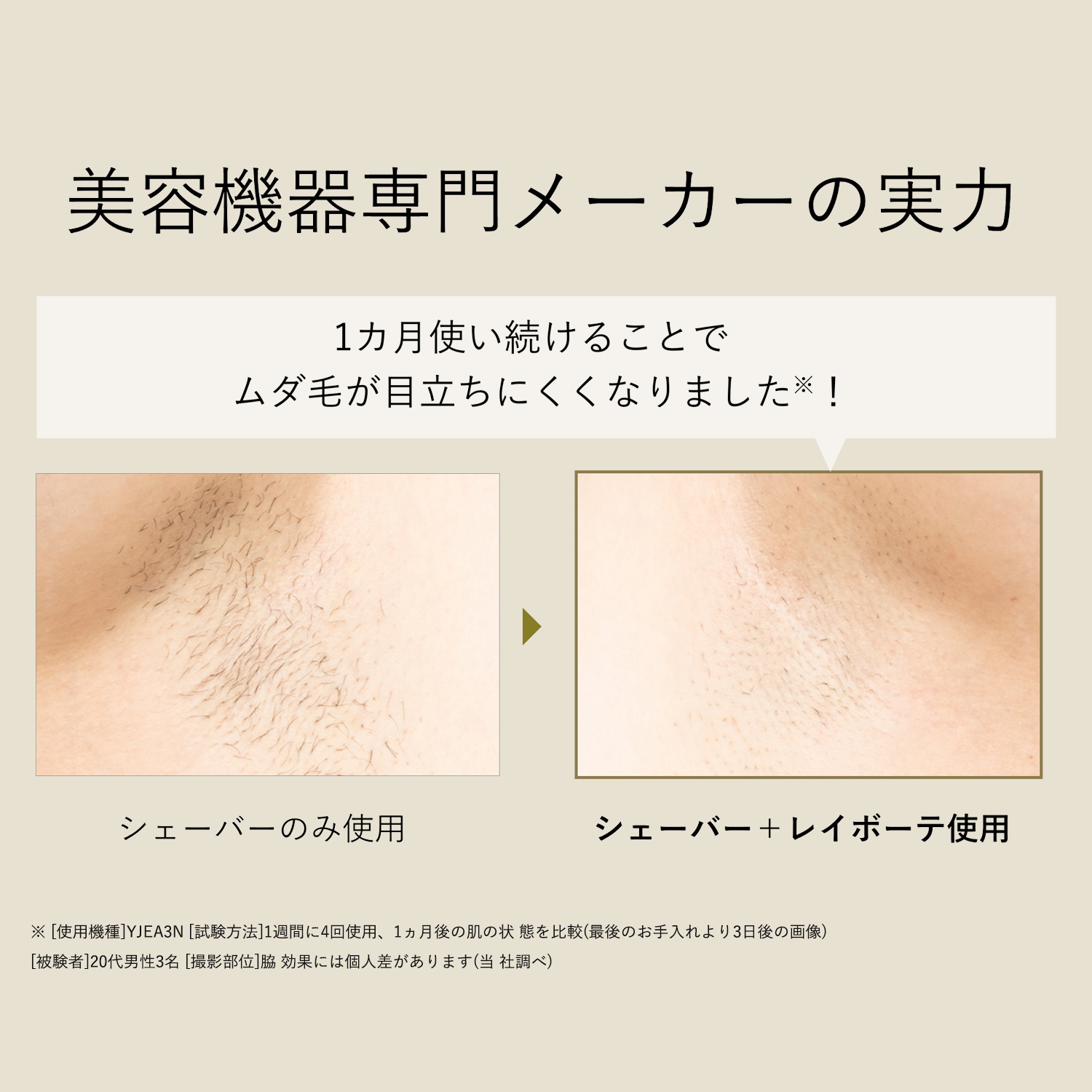 レイボーテ クールプロ｜ヤーマン公式通販サイト | ヤーマンオンライン