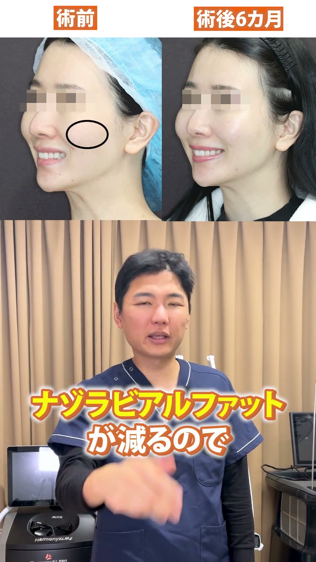 The small face magic will make you feel more excited than ever