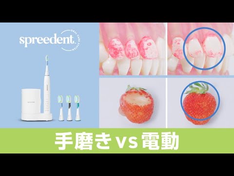 SPREEDENT】2ミニッツ 電動パワー歯ブラシ 手磨きvs電動比較動画 - YouTube