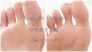 フットケアローション - SpaLuce（スパルーチェ）公式サイト