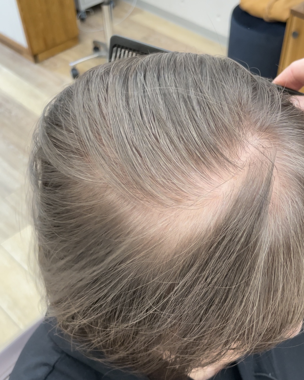 白髪率90％のカラーリング最適解