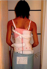 側湾症 【大塚整体治療院】 そくわん症 側わん症 側弯症